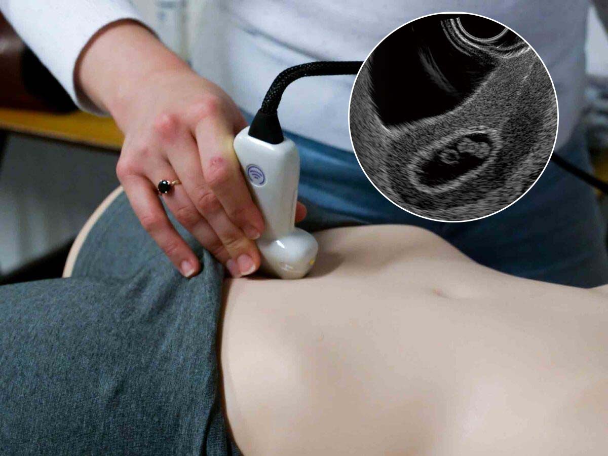 Ultrasound Training Simulator Featuring Early Pregnancy