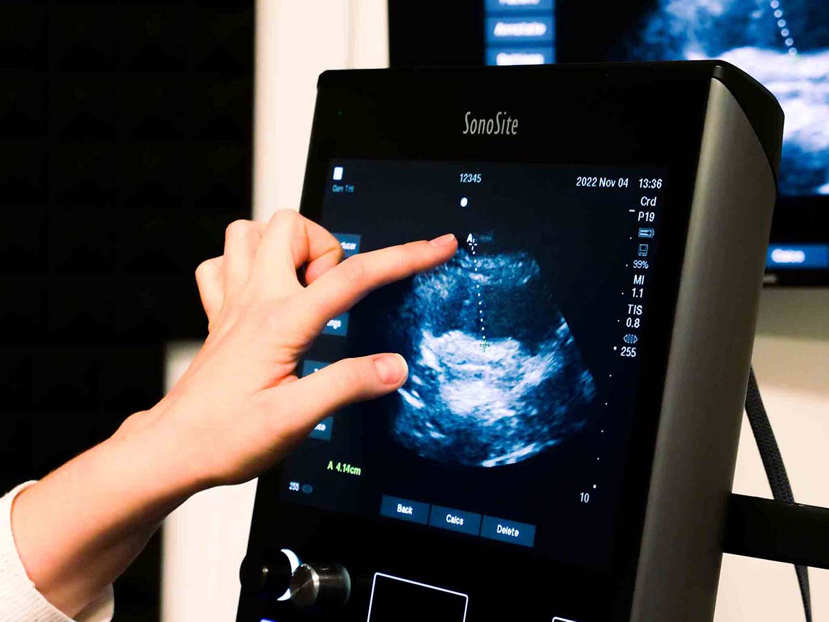 Ultrasound training for Sexual Health Clinicians