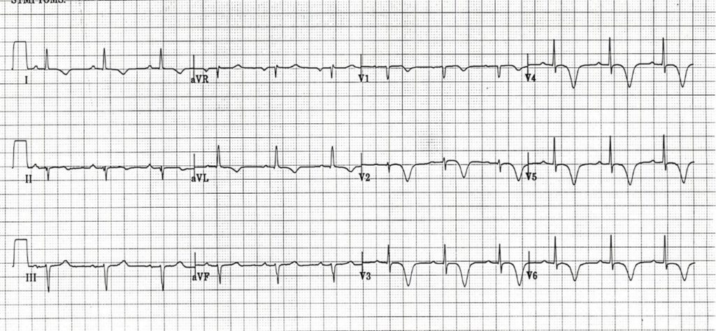 MRCEM SBA Quiz 6 - FRCEM, MRCEM, Ultrasound Emergency Medicine Courses