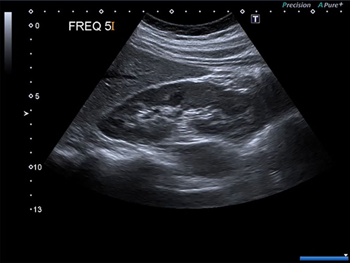 ultrasound scan