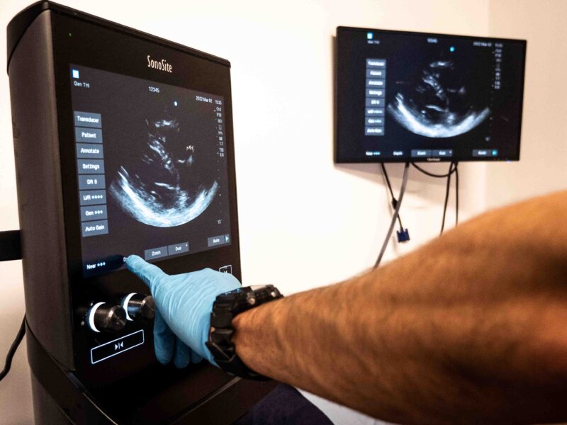 Core Emergency Ultrasound Course (Level 1) Bromley Emergency Courses